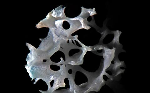 Human trabecular bone